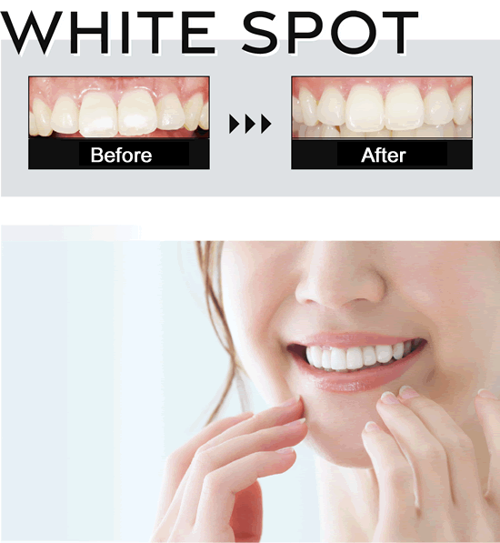 White Spot Treatment